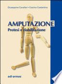 Amputazione. Protesi e riabilitazione