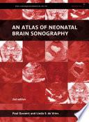 An Atlas of Neonatal Brain Sonography