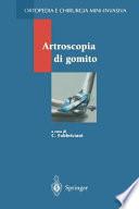 Artroscopia di gomito