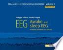 Atlas of Electroencephalography
