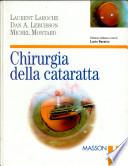 Chirurgia della cataratta