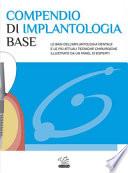 Compendio di implantologia base