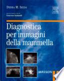 Diagnostica per immagini della mammella