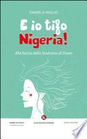 E io tifo Nigeria! Alla faccia della sindrome di Down