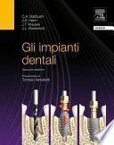 Gli impianti dentali