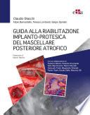 Guida alla riabilitazione implantoprotesica del mascellare posteriore atrofico