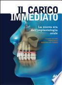 Il carico immediato. La nuova era dell'implantologia orale