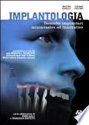 Implantologia. Tecniche implantari mininvasive e innovative
