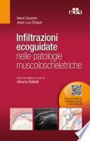 Infiltrazioni ecoguidate nelle patologie muscoloscheletriche