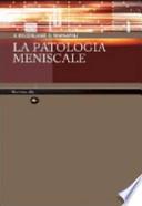La patologia meniscale