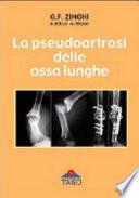 La pseudoartrosi delle ossa lunghe