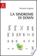 La sindrome di Down
