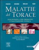 Malattie del torace