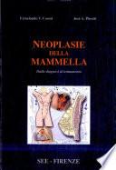 Neoplasie Della Mammella