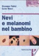 Nevi e melanomi nel bambino