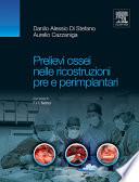 Prelievi ossei nelle ricostruzioni pre e perimplantari
