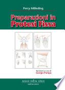 Preparazioni in Protesi Fissa