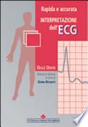 Rapida e accurata interpretazione dell'ECG