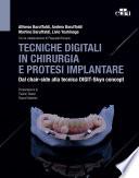 Tecniche digitali in chirurgia e protesi implantare